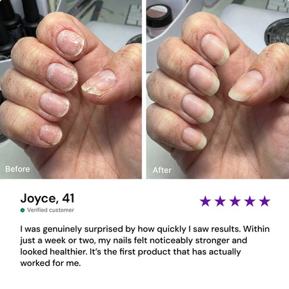 Nourishing Nail Pen
